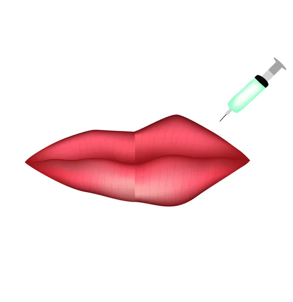 Suntikan Untuk Augmentasi Bibir Botox Bibir Sebelum Dan Sesudah Prosedur - Stok Vektor