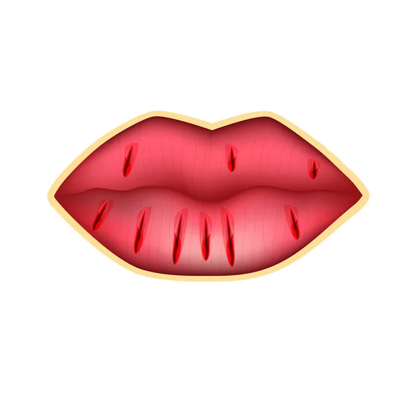 Cracks Lips Dry Chapped Lips Infographics Vector Illustration Isolated Background — Stock Vector