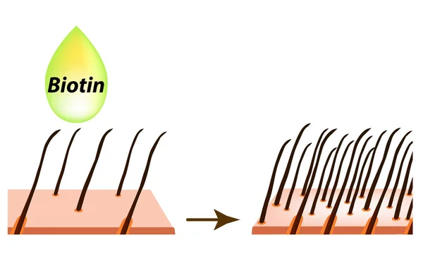 Tratamento Alopecia Cabelo Vitaminas Biotina Seborreia Pele Cabelo Caspa Dermatite —  Vetores de Stock