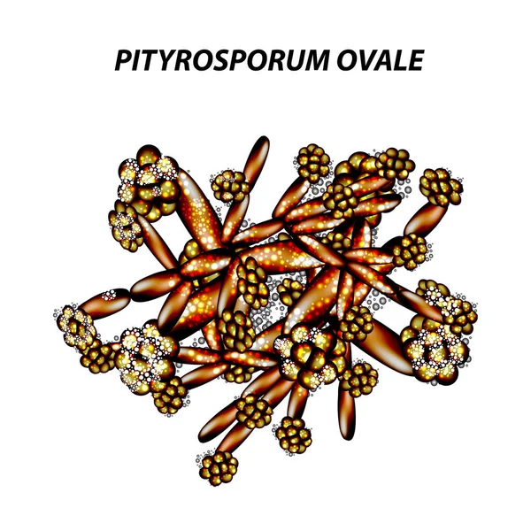 Levure Fongique Pathogène Séborrhée Pityrosporum Ovale Malassezia Furfur Seborrhea Peau — Image vectorielle