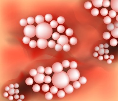 Püstüler tipi sedef doku. Egzama deri hastalığı dermatit. Infographics. Vektör çizim