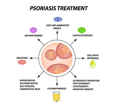 Psoriasis treatment. Eczema, dermatitis skin disease psoriasis. Infographics. Vector illustration on isolated background clipart