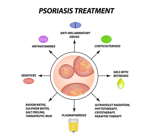 Tratamiento Psoriasis Eczema Dermatitis Psoriasis Piel Infografías Ilustración Vectorial Sobre — Vector de stock