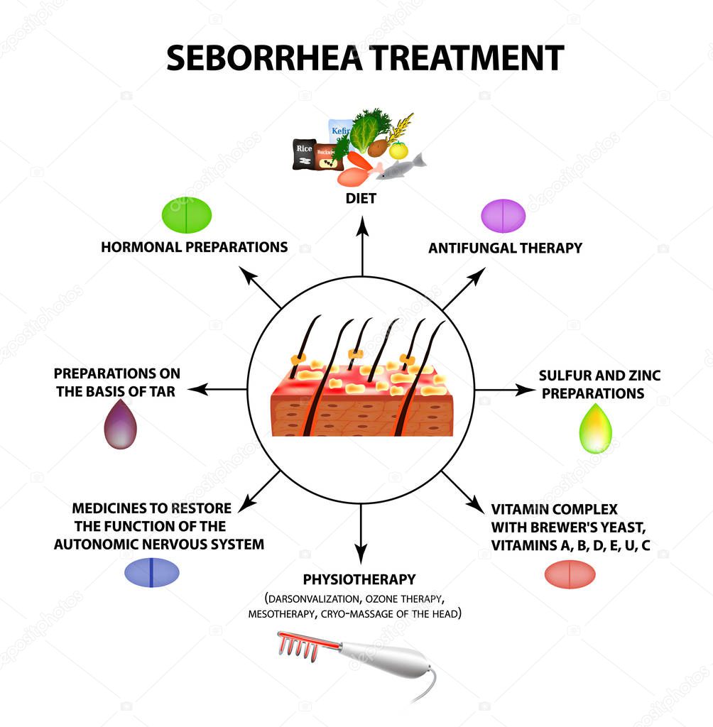 Treatment of seborrhea. Seborrhea skin and hair. Dandruff, seborrheic dermatitis. Baldness, hair growth, baldness. Anatomical structure. Infographics. Vector illustration on isolated background