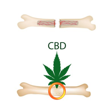 Kemikler ve kırıklar kenevir yağı etkisi. Cannabinoid tedavi. Esrar özellikleri. Vektör illüstrasyon izole arka plan üzerinde