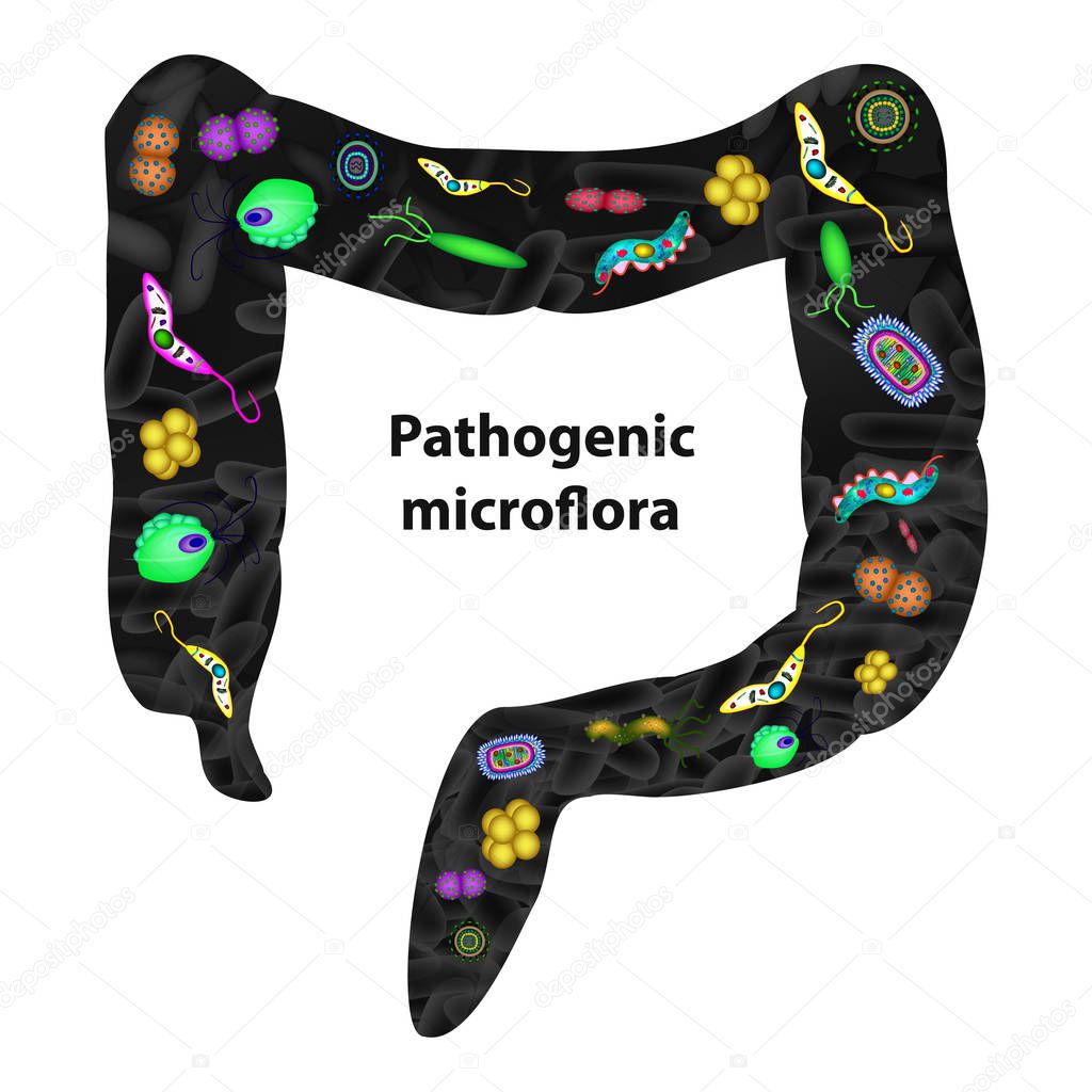 Pathogenic microflora in the intestine. Dysbacteriosis. Dysbiosis. Killed the good bacteria flora in the colon. Infographics. Vector illustration on isolated background