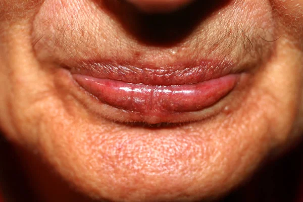 Lips with lowered corners. Wrinkles on the lips. Nasolabial folds — Stock Photo, Image