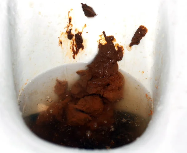 带棕色粪便的马桶。被排泄物弄脏的厕所. — 图库照片