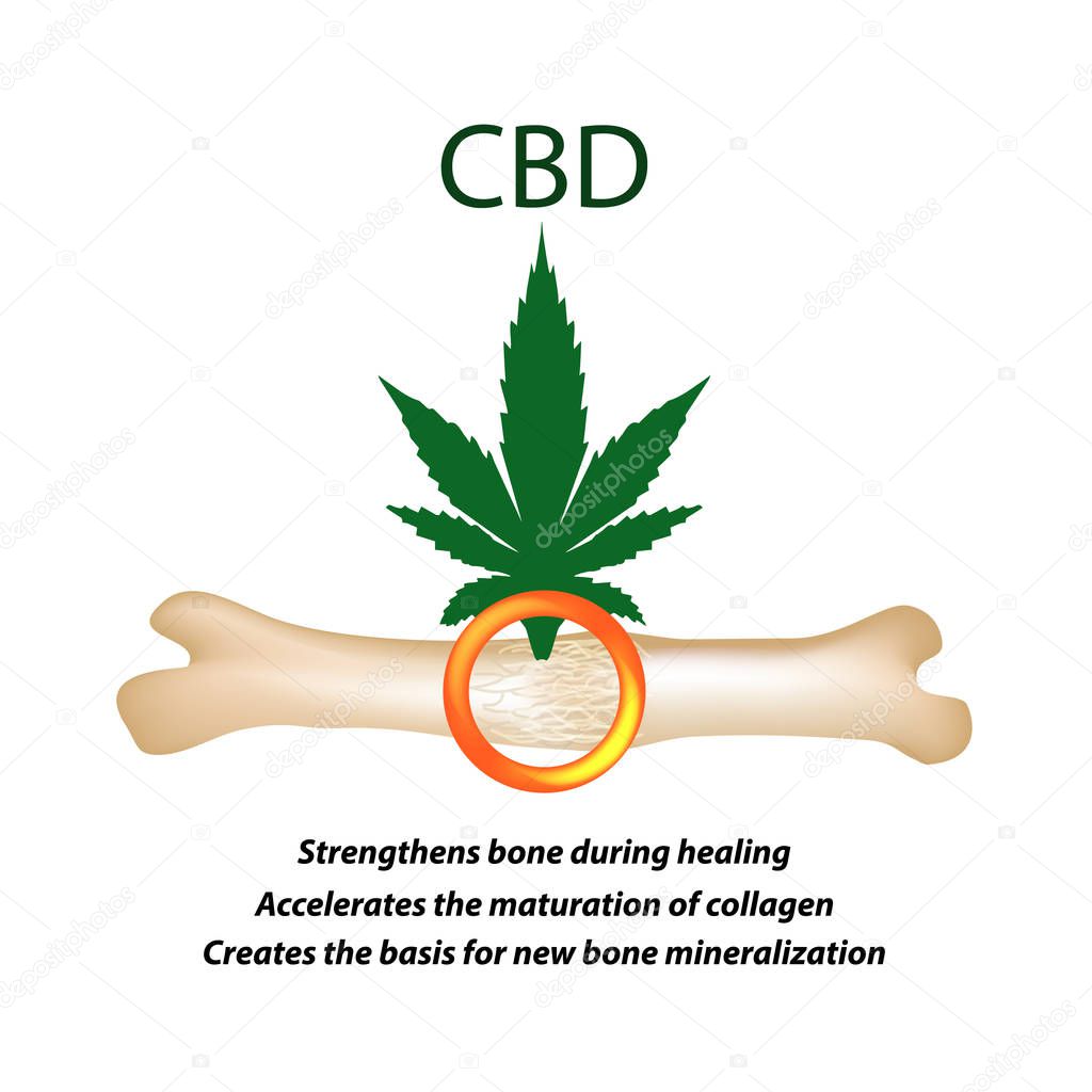 Effect of cannabis oil on bones and fractures. Cannabinoid treatment. Marijuana properties. Vector illustration on isolated background.