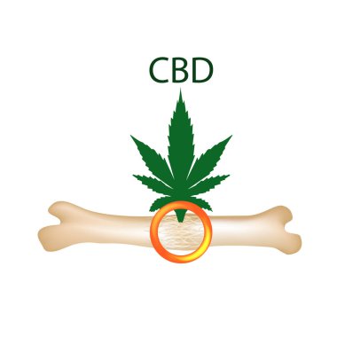 Kemikler ve kırıklar kenevir yağı etkisi. Cannabinoid tedavi. Esrar özellikleri. Vektör illüstrasyon izole arka plan üzerinde.