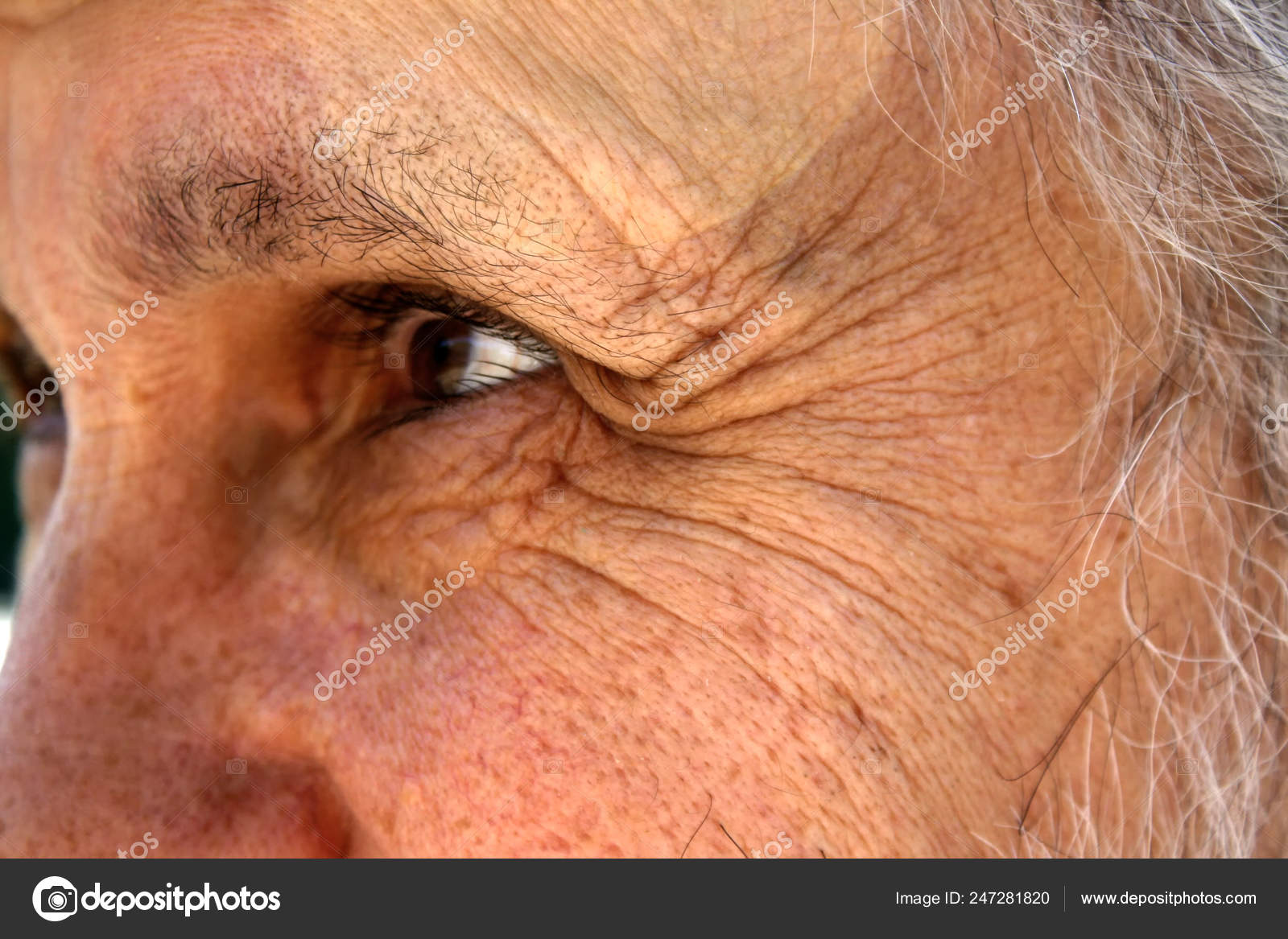 deep wrinkle between eyes