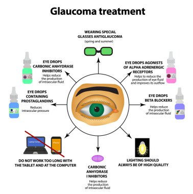 Glokom tedavisi. Göz damlası. Dünya glokom günü. Gözün anatomik yapısı. Infographics. Vektör illüstrasyon izole arka plan üzerinde