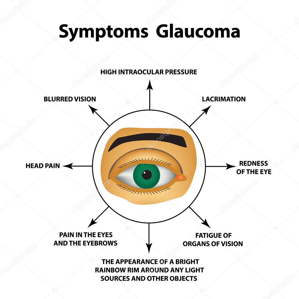 Symptoms of glaucoma. World glaucoma day. The anatomical structure of the eye. Infographics. Vector illustration on isolated background