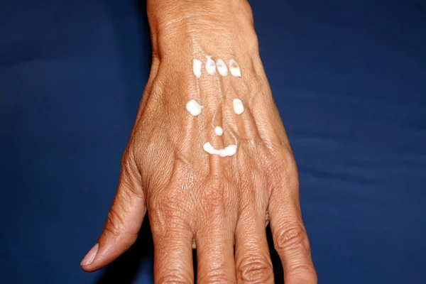 Mano vieja. Brazo con grandes venas abultadas. Aplicar una crema curativa en la mano en forma de sonrisa . — Foto de Stock