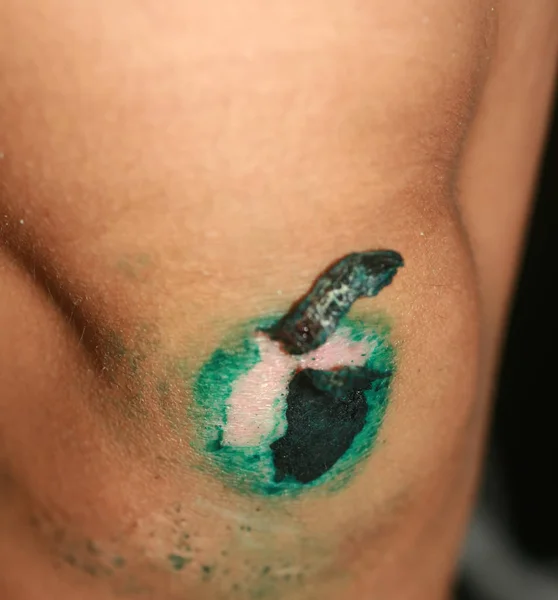 Healing wound on the knee. The wound treated with brilliant green. The scab will climb — Stock Photo, Image