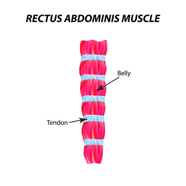 La estructura del músculo esquelético. músculo recto del abdomen. Tendón. Infografías. Ilustración vectorial sobre fondo aislado. — Archivo Imágenes Vectoriales