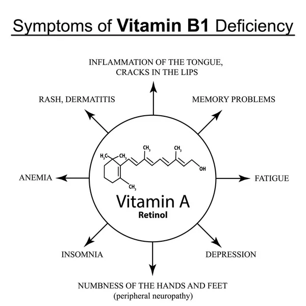 B1 vitamini eksikliği belirtileri. ınfographics. Yalıtılmış bir arka plan üzerinde vektör çizimi. — Stok Vektör