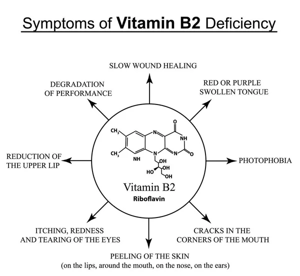 Síntomas de deficiencia de vitamina B2. Infografías. Ilustración vectorial sobre un fondo aislado . — Vector de stock