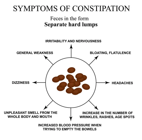 변비의 증상. 양 대변 인포 그래픽. 격리된 배경의 벡터 그림. — 스톡 벡터