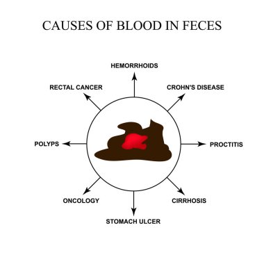 Causes of blood in feces. Diseases of the gastrointestinal tract. Infographics. Vector illustration on isolated background. clipart