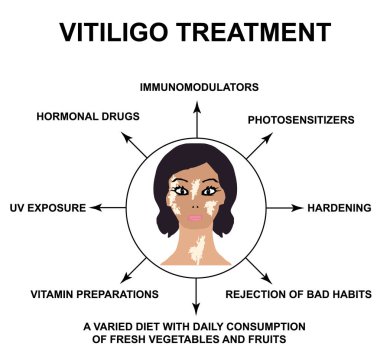 Vitiligo tedavisi. Dünya Vitiligo Günü. ınfographics. Yalıtılmış arka planda vektör çizimi.