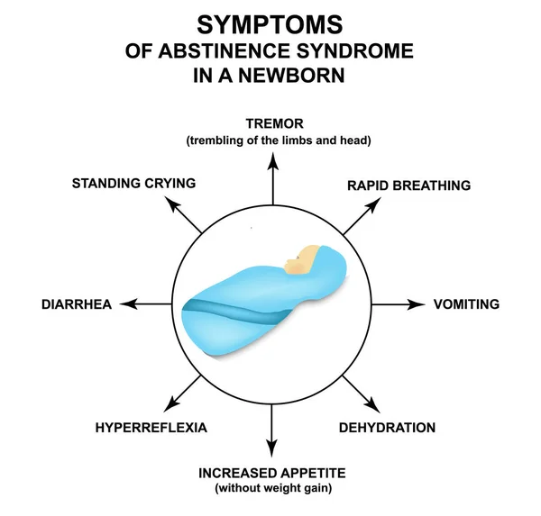 Симптомы синдрома воздержания у новорожденных. Инфографика. синдром ломки у младенцев. Векторная иллюстрация на изолированном фоне . — стоковый вектор