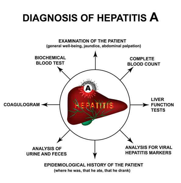 Diagnose Hepatitis a. Welttag der Hepatitis. Infografiken. Vektor-Illustration auf isoliertem Hintergrund. — Stockvektor