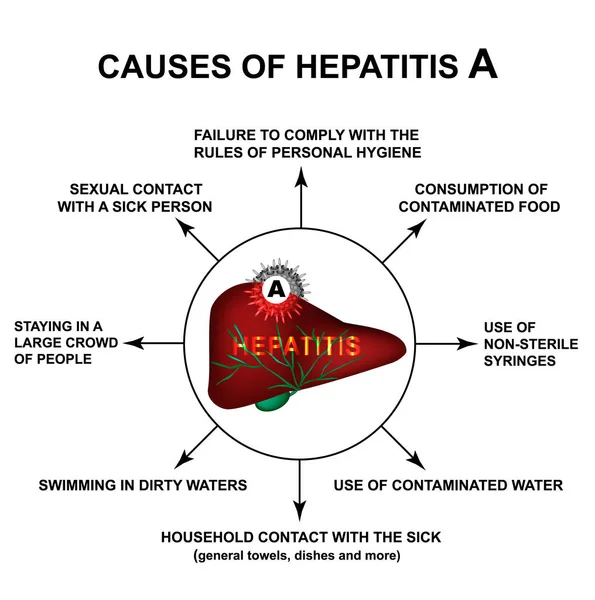 Causas de la hepatitis A. Día Mundial de la Hepatitis. Infografías. Ilustración vectorial sobre fondo aislado . — Vector de stock