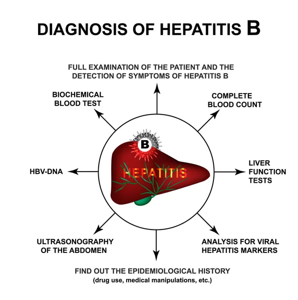 Diagnóstico de hepatitis B. Día Mundial de la Hepatitis. Infografías. Ilustración vectorial sobre fondo aislado . — Vector de stock