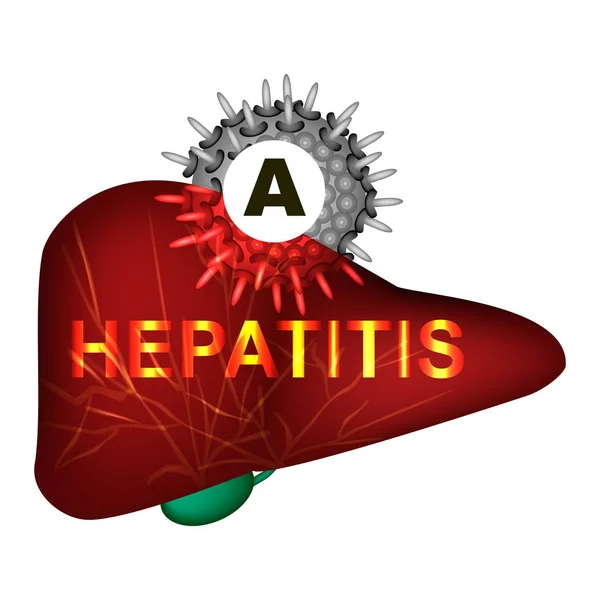 Hepatitis A. Día Mundial de la Hepatitis. Infografías. Ilustración vectorial sobre fondo aislado . — Vector de stock