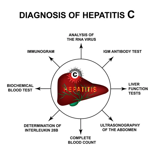 Diagnóstico de hepatitis C. Día Mundial de la Hepatitis. Infografías. Ilustración vectorial sobre fondo aislado . — Vector de stock