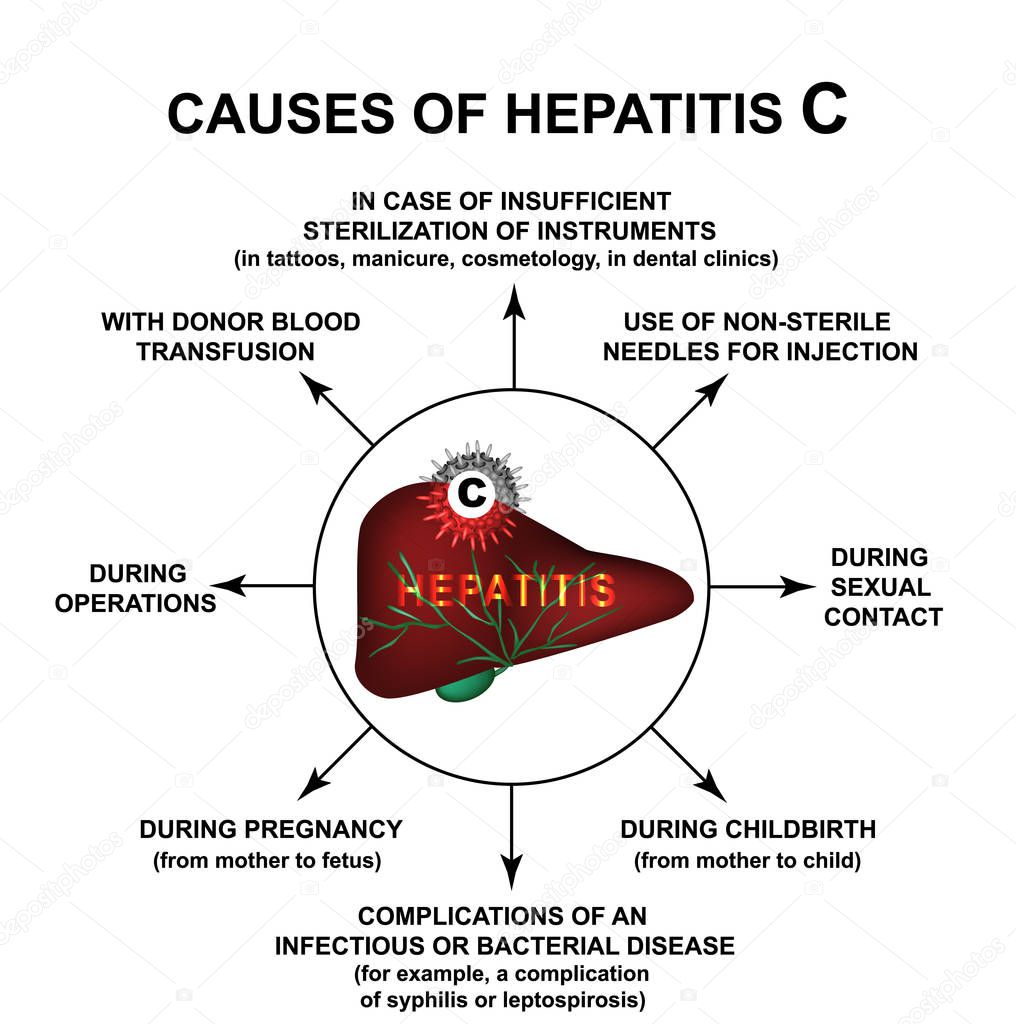 Causes of Hepatitis C. World Hepatitis Day. Infographics. Vector illustration on isolated background.