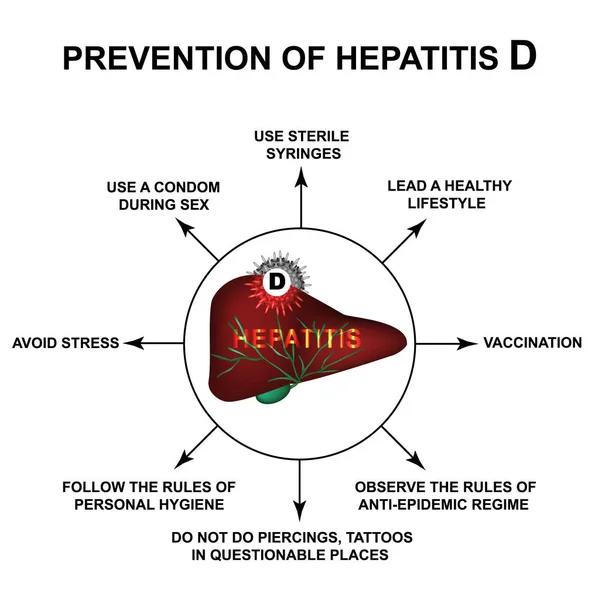 D型肝炎の世界性肝炎の予防インフォグラフィック。分離された背景のベクトルイラストレーション. — ストックベクタ