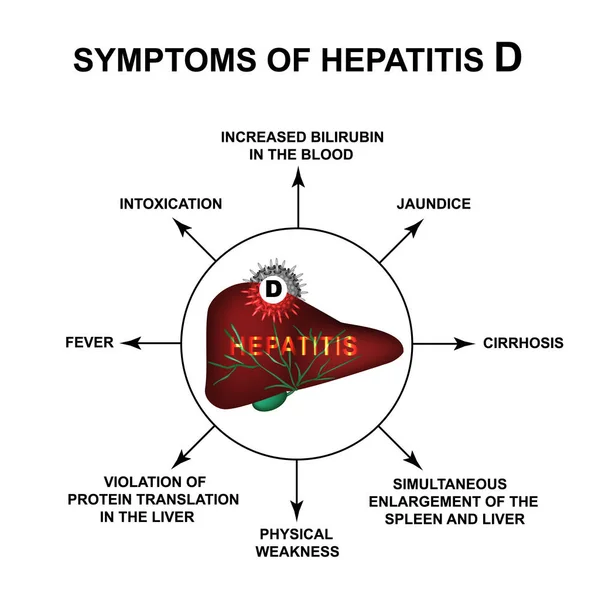 Síntomas de la hepatitis D. Día Mundial de la Hepatitis. Infografías. Ilustración vectorial sobre fondo aislado . — Vector de stock