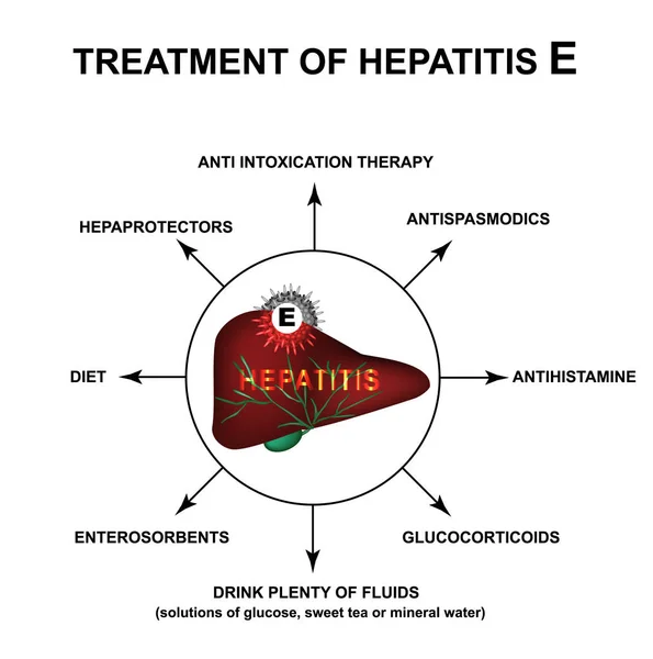 Trattamento dell'epatite E. Giornata mondiale dell'epatite. Infografica. Illustrazione vettoriale su sfondo isolato . — Vettoriale Stock