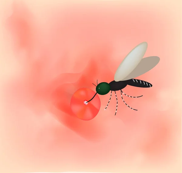 Picadura de mosquito en la piel. Día mundial del mosquito. Ilustración vectorial sobre fondo aislado . — Archivo Imágenes Vectoriales