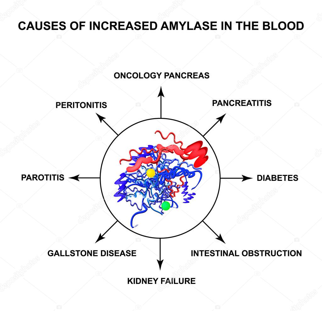 Causes of increased amylase in the blood. The enzyme amylase. Infographics. Vector illustration on isolated background