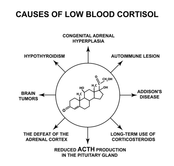 Причины низкого содержания кортизола в крови. Гормон стресса кортизол является химической молекулярной формулой. Инфографика. Векторная иллюстрация на изолированном фоне
.