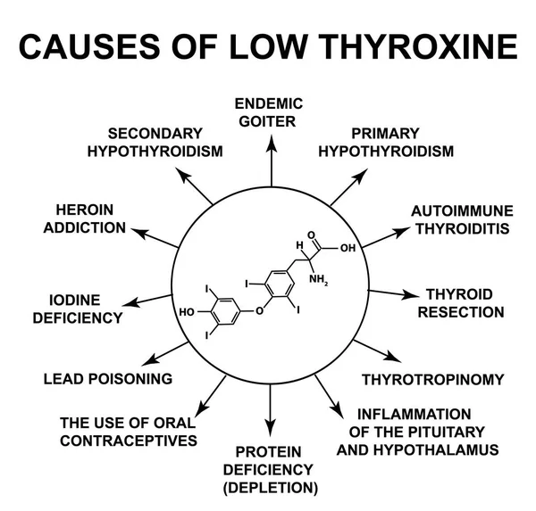 Causes of low thyroxine. Thyroid hormone thyroxine chemical molecular formula. Infographics. Vector illustration on isolated background. — Stock Vector