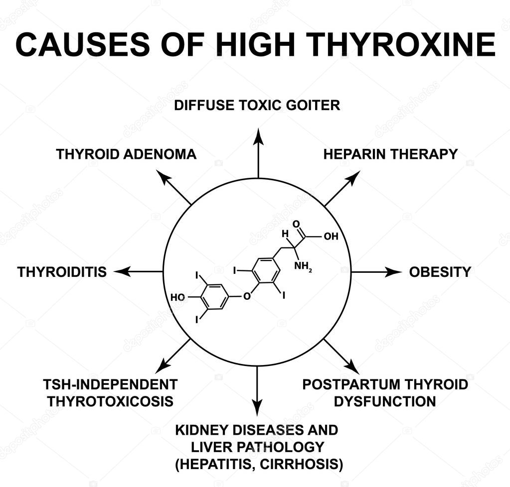 Causes of high thyroxine. Thyroid hormone thyroxine chemical molecular formula. Infographics. Vector illustration on isolated background.