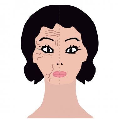 Yüzün bir yarısında kırışıklıklar var. Hyaluronik asit ile tedavi. ınfographics. İzole arka planda vektör Illustration.