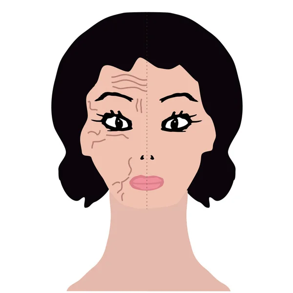 Arrugas en la mitad de la cara. Tratamiento con ácido hialurónico. Infografías. Ilustración vectorial sobre fondo aislado . — Vector de stock
