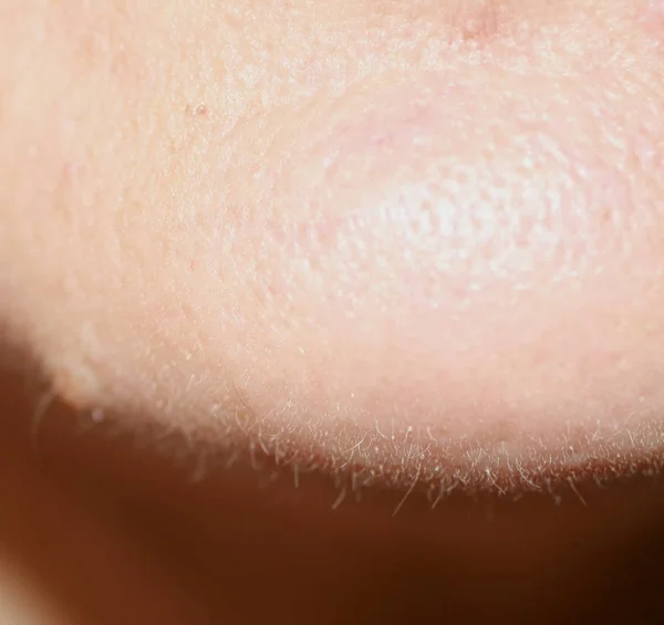 The hair on the face of a woman. Chin hair. — Stock Photo, Image