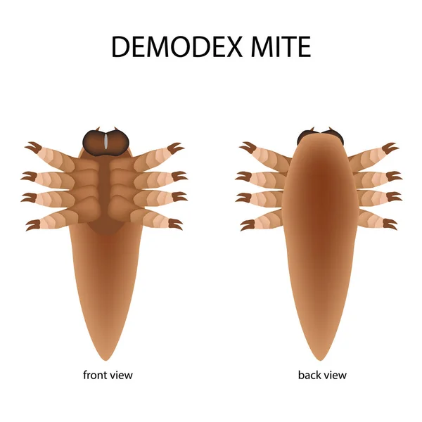 The structure of the demodex mite. Front view and rear view. Demodecosis. Infographics. Vector illustration on isolated background. — Stock Vector