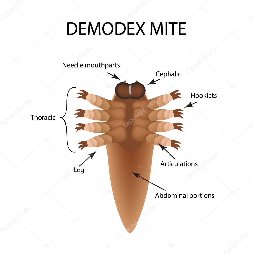 The structure of the demodex mite. Demodecosis. Infographics. Vector illustration on isolated background.
