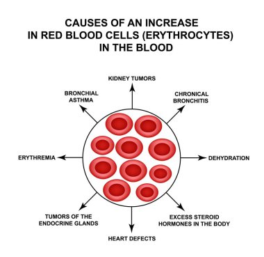 Artan kırmızı kan hücrelerinin nedenleri. Hücre eritrositleri. Hemoglobin. Kırmızı kan hücrelerinin yapısı. ınfographics. Yalıtılmış arka planda vektör çizimi.