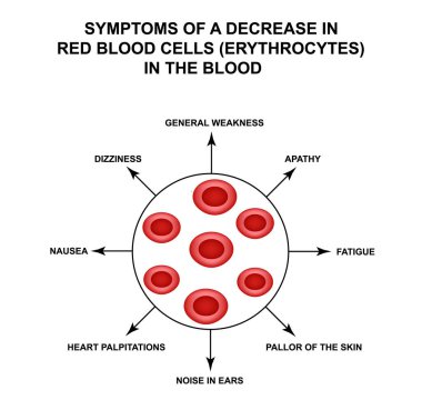 Kandaki kırmızı kan hücrelerinde azalma belirtileri. Hücre eritrositleri. Hemoglobin. Kırmızı kan hücrelerinin yapısı. ınfographics. Yalıtılmış arka planda vektör çizimi.