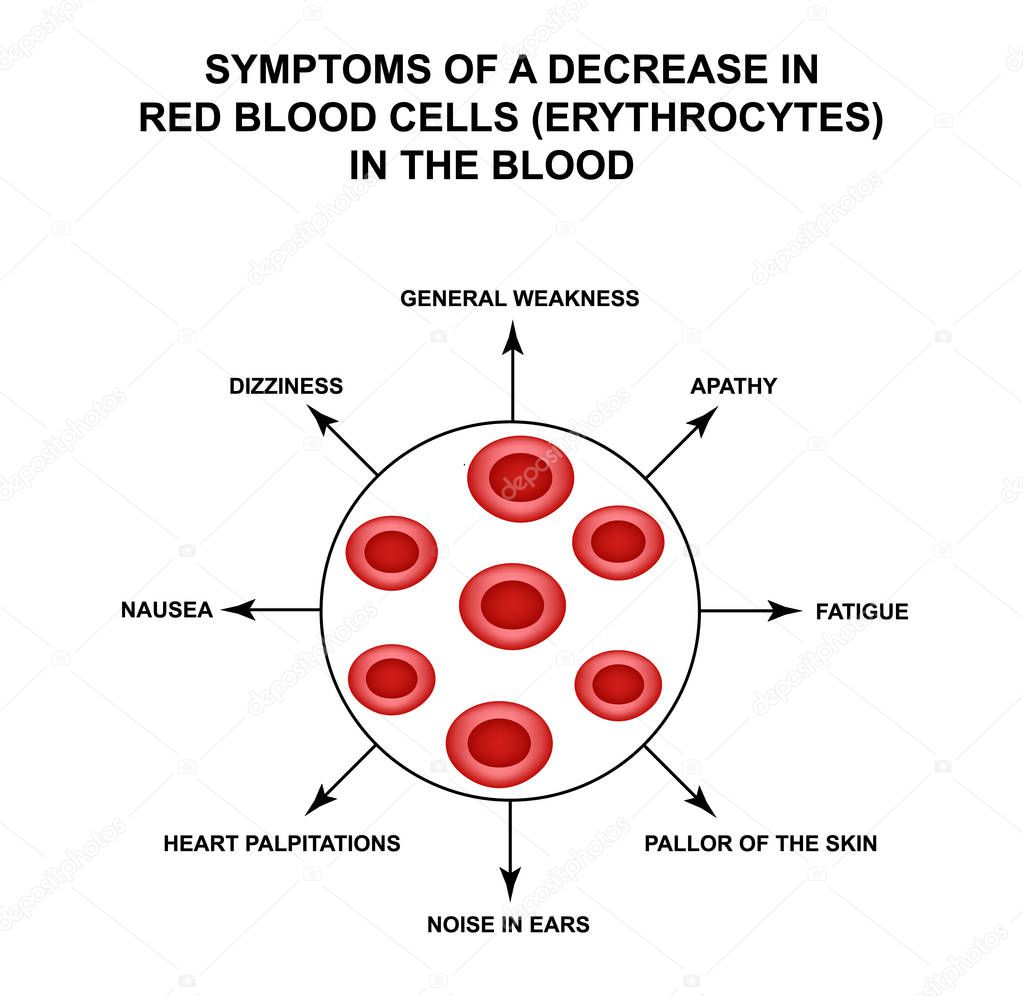 Symptoms of a decrease in red blood cells in the blood. Cells erythrocytes. Hemoglobin. The structure of red blood cells. Infographics. Vector illustration on isolated background.