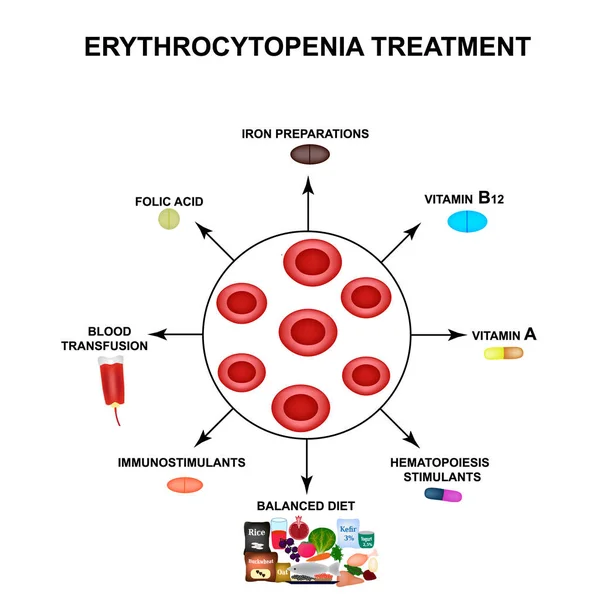 Tratamiento de la eritrocitopenia. Reducir los glóbulos rojos. Células eritrocitos. Hemoglobina. La estructura de los glóbulos rojos. Infografías. Ilustración vectorial sobre fondo aislado . — Vector de stock