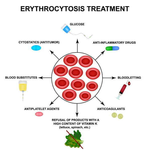 Erytrocytos behandling. Ökade röda blodkroppar. Celler erytrocyter. Hemoglobin. Strukturen av röda blodkroppar. Infographics. Vektor illustration på isolerad bakgrund. — Stock vektor